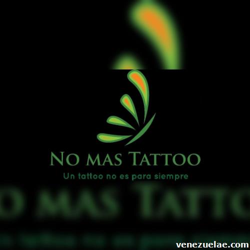 Eliminación de tatuajes