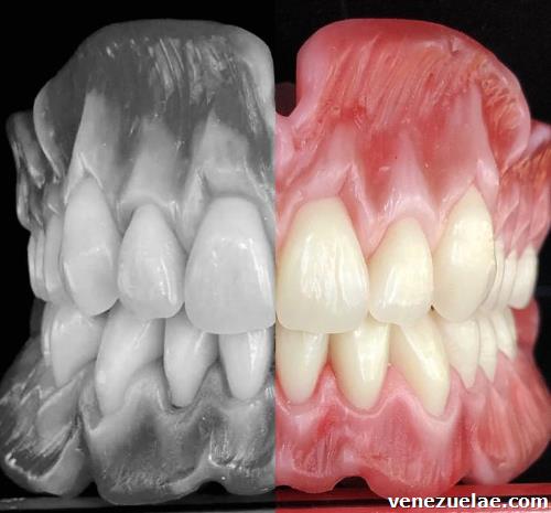 Odontología en valencia carabobo
